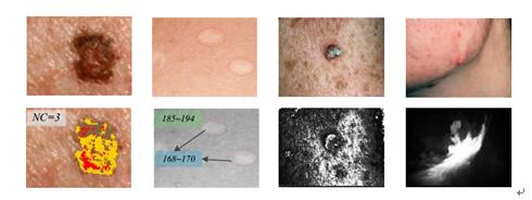 皮肤治疗2.jpg 皮肤治疗2.jpg